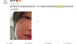吃瓜捏爆眼球视频下载,揭秘“吃瓜捏爆眼球”视频下载背后的秘密